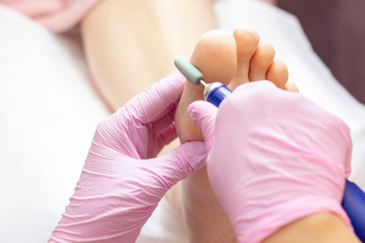 specialiste-en-soins-de-pieds-a-montrea-Quebec